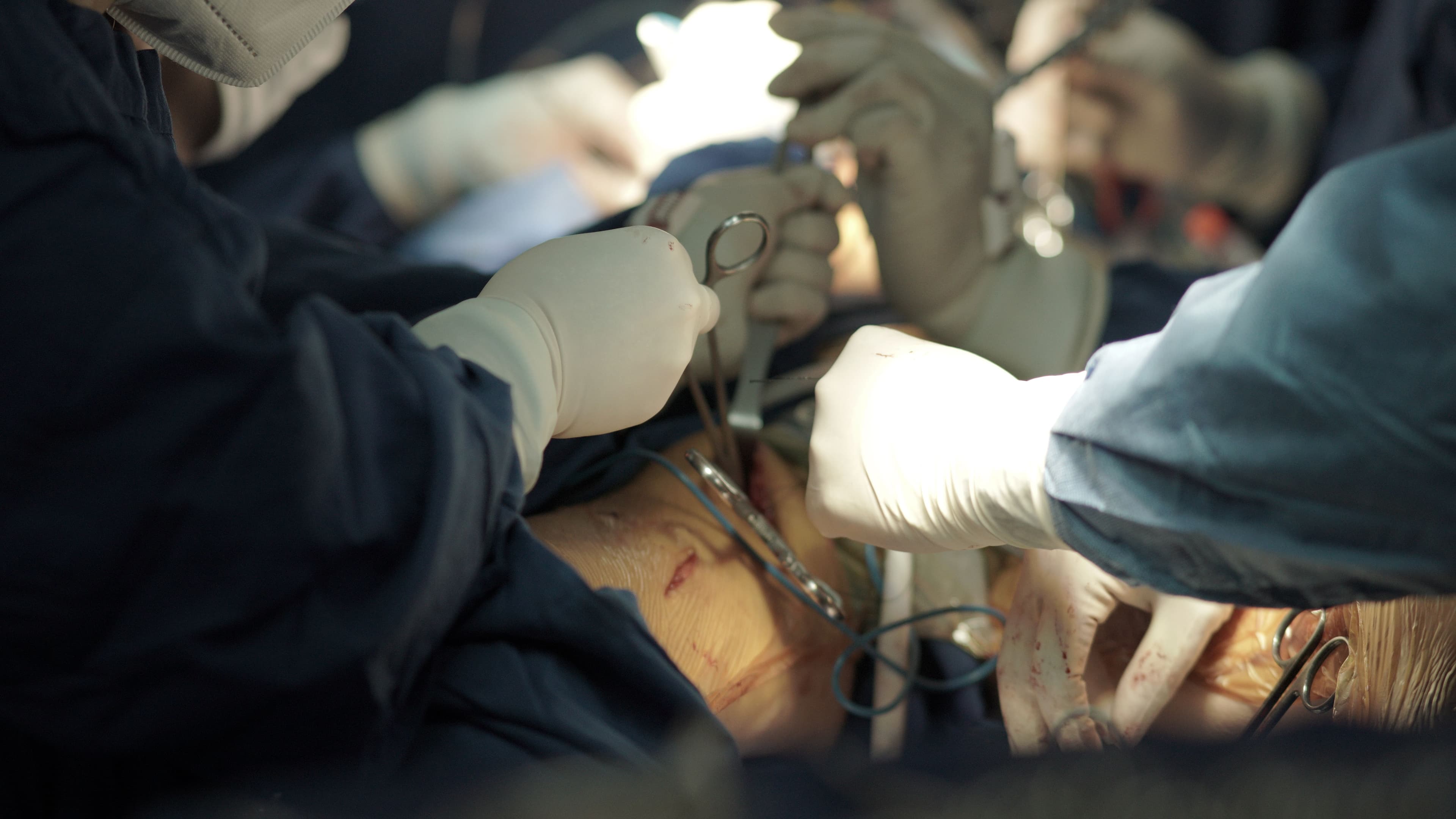 Bone Marrow Transplant