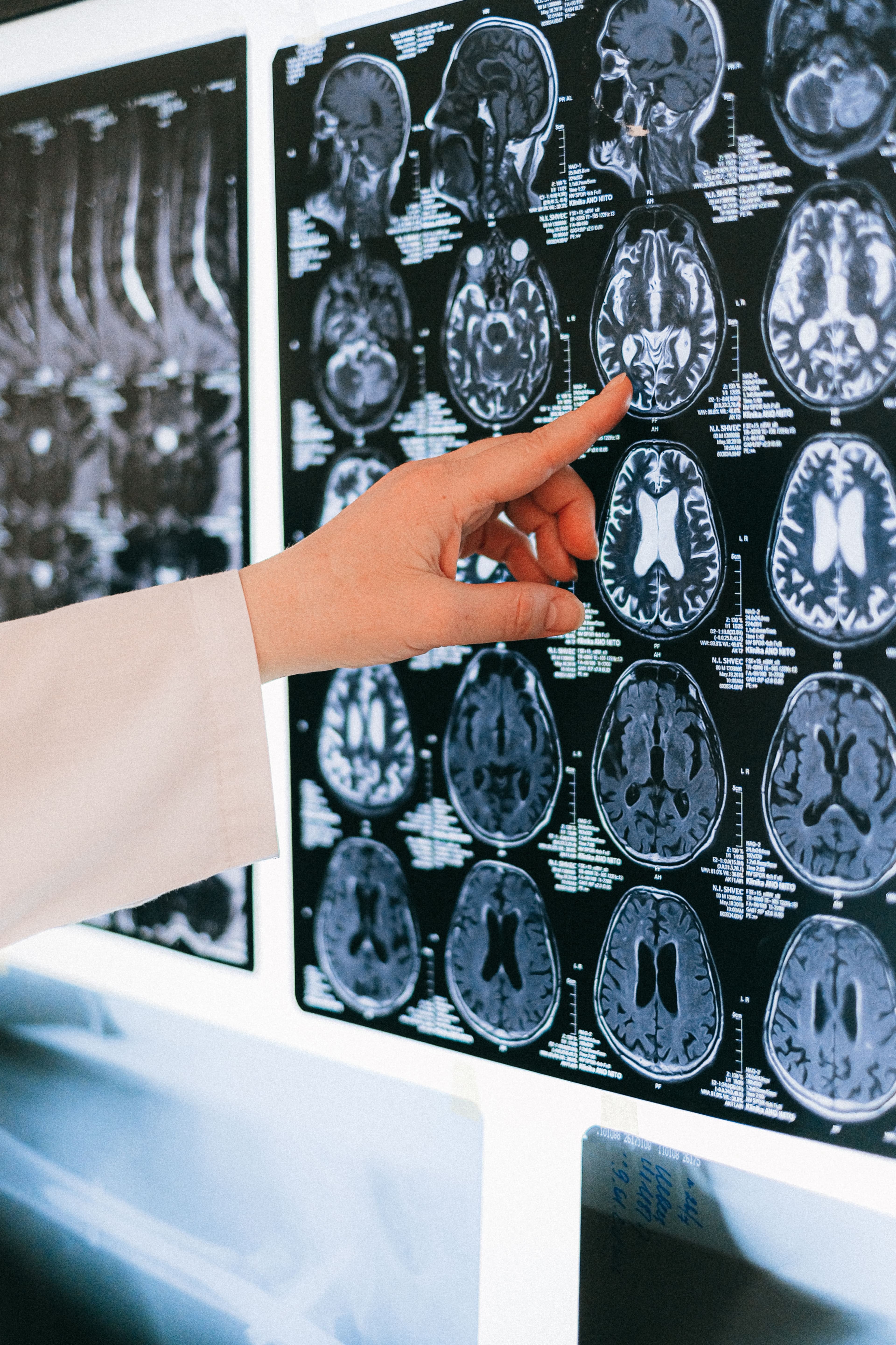 Pediatric Neurology & Neurosurgery