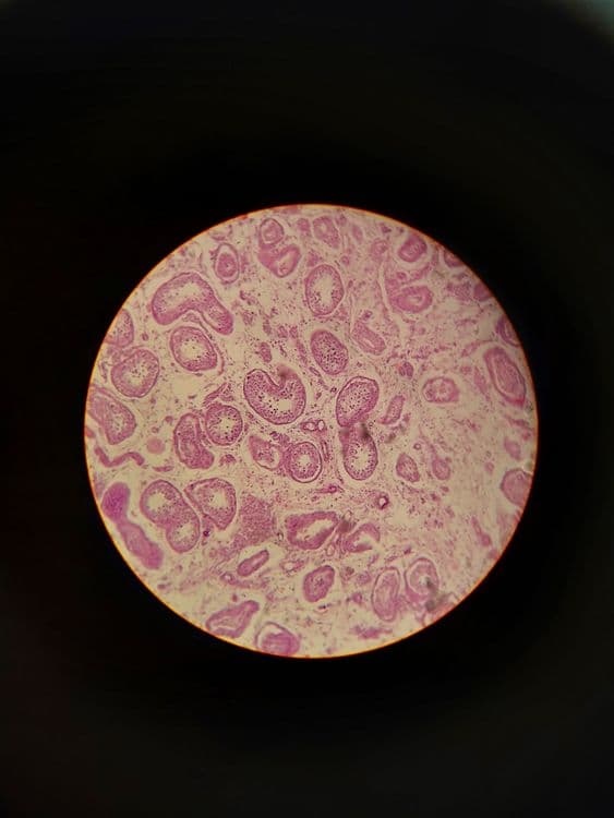 Stem Cell Therapy