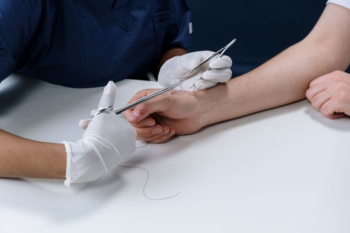 Burn Reconstruction and Skin Grafting