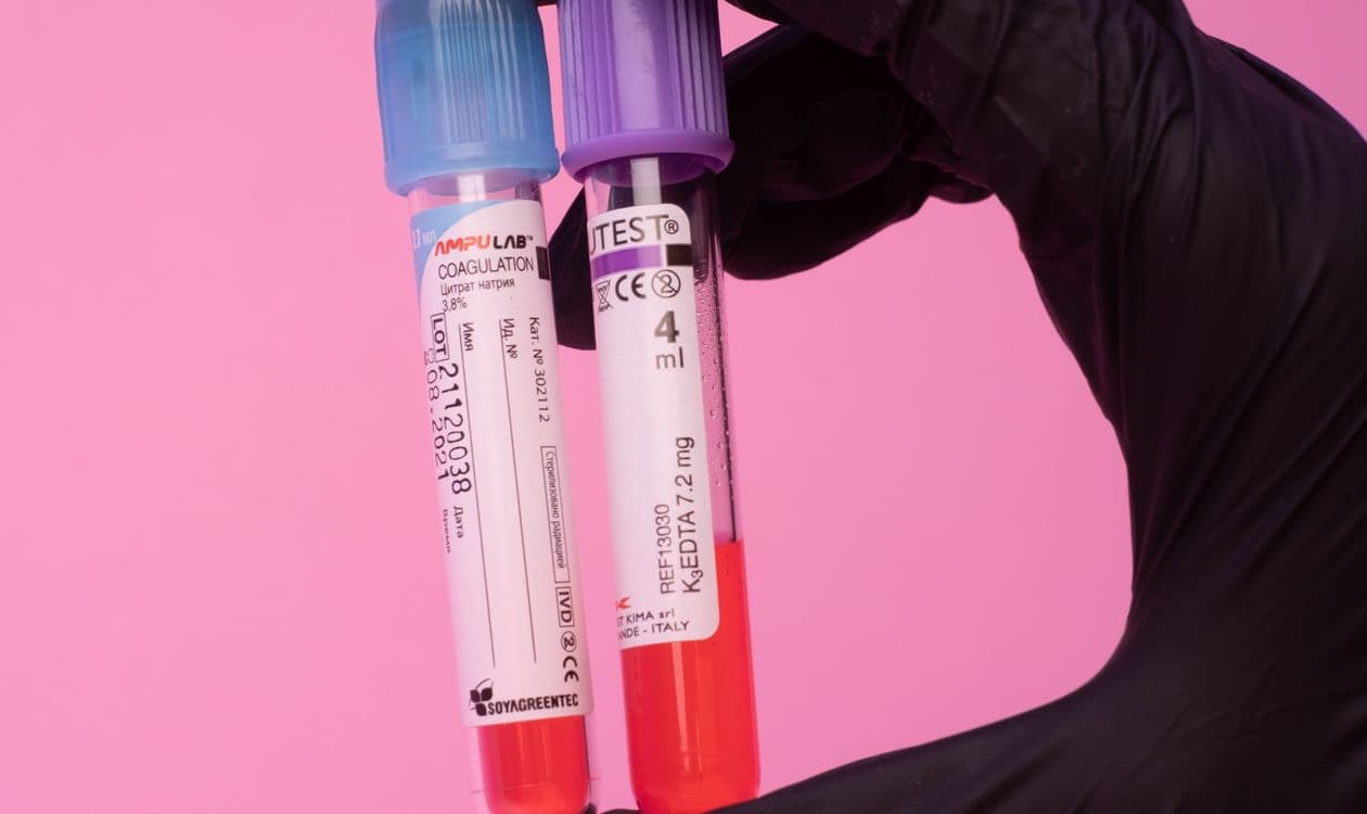 Hormone Replacement Therapy