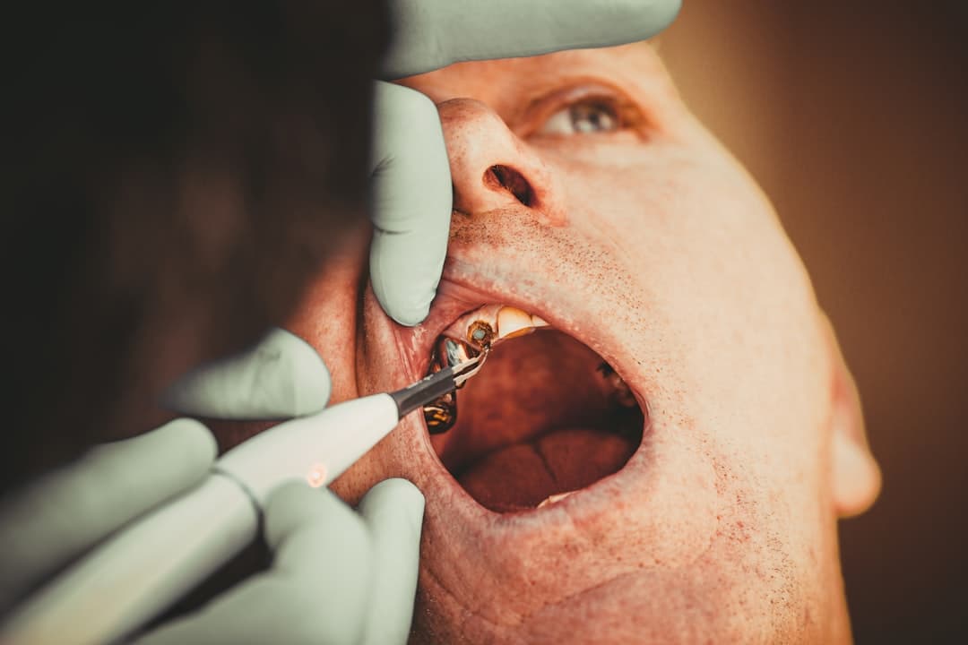 Tonsillectomy and Adenoidectomy