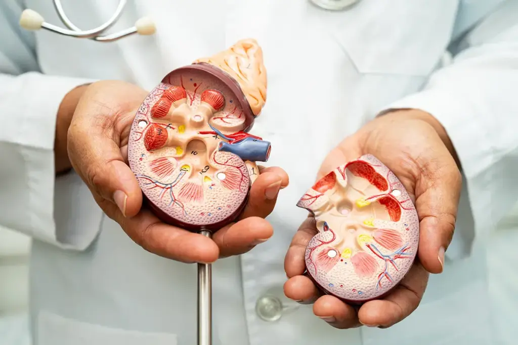 Kidney Transplant