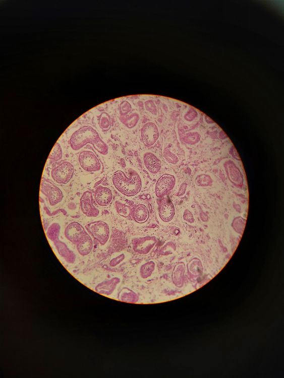Stem Cell Therapy