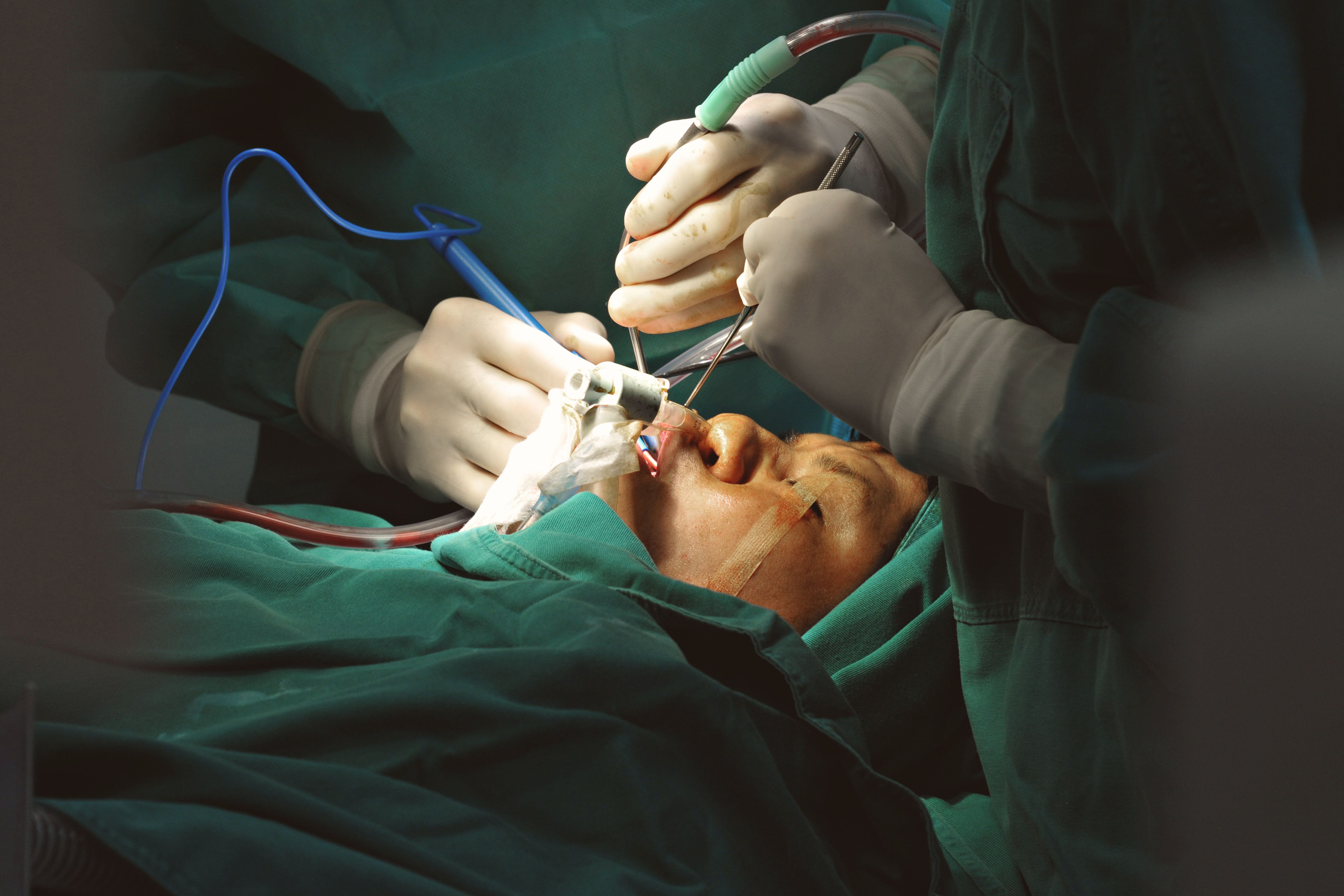 Cleft Lip and Palate Repair